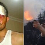 Engelli vatandaşı kör eden polise takipsizlik kararı! 12