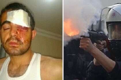 Engelli vatandaşı kör eden polise takipsizlik kararı! 21