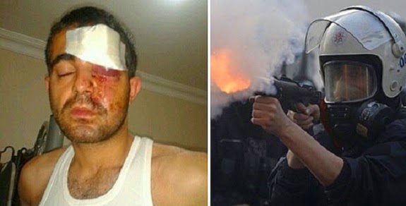 Engelli vatandaşı kör eden polise takipsizlik kararı! 11