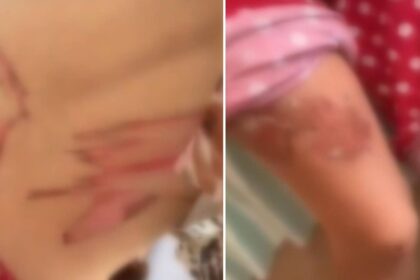 Gece boyunca ısıtılmış bıçak ile işkence edildi! 25