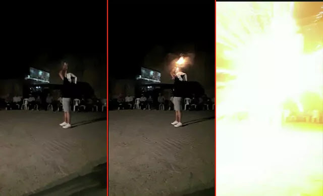 Kafasının üzerinde havai fişek patlatan genç canından oluyordu 11 Kafasının üzerinde havai fişek patlatan genç canından oluyordu 11