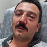 Güvenlik görevlisini darp ettiler, burnunu kırdılar! 12