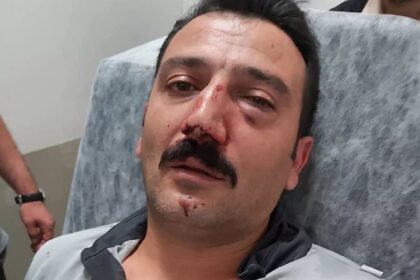 Güvenlik görevlisini darp ettiler, burnunu kırdılar! 21