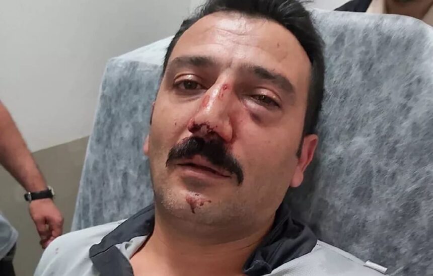 Güvenlik görevlisini darp ettiler, burnunu kırdılar! 11