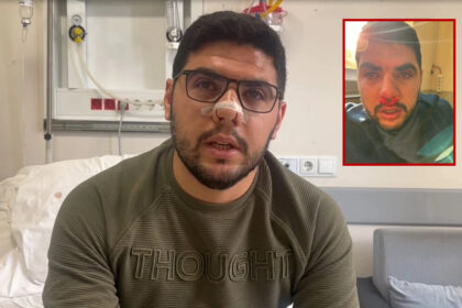 Hasta yakını hemşireye saldırdı 36